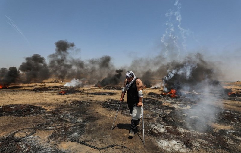 Gaz bombası Filistinli göstericiyi ağzından yaraladı A24