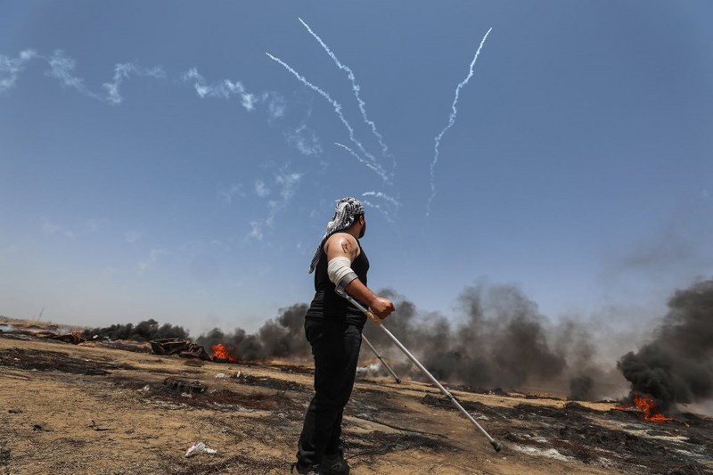 Gaz bombası Filistinli göstericiyi ağzından yaraladı A24
