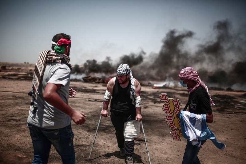 Gaz bombası Filistinli göstericiyi ağzından yaraladı A24
