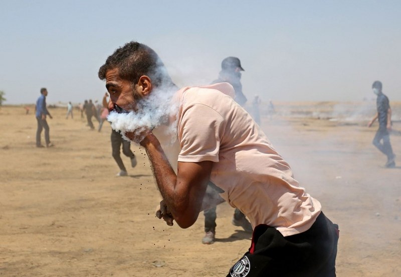 Gaz bombası Filistinli göstericiyi ağzından yaraladı A24